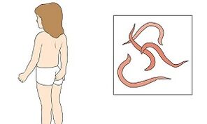 parasiitide esinemise sümptomid inimese kehas