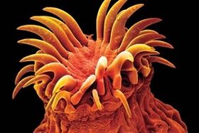 Trematoodide parasiidid inimestel