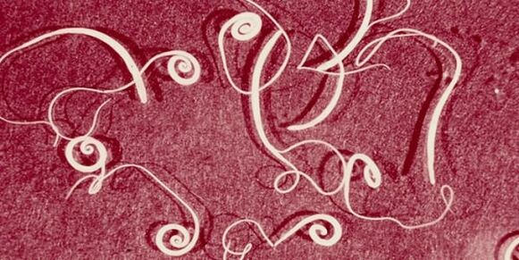 foto inimese parasiitidest