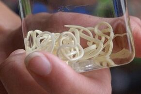 parasiidid inimkehast