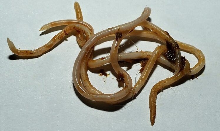 toksokara inimkehast